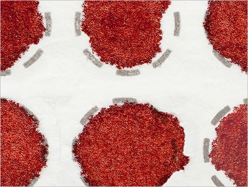 AnyConv.com__advantage_diagnostics_3311A-AcylcarnitinesAminoAcids