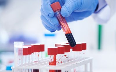 Prepare samples in less time and run analyses faster—Restek Essentials